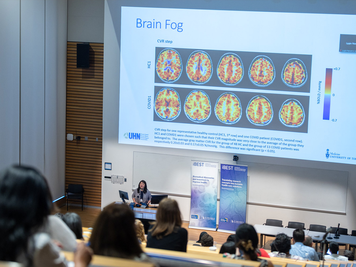 The back of several audience’s heads as they watch Dr. Angela Cheung at the front of a lecture theatre showing a slide on brain fog and long COVID. 